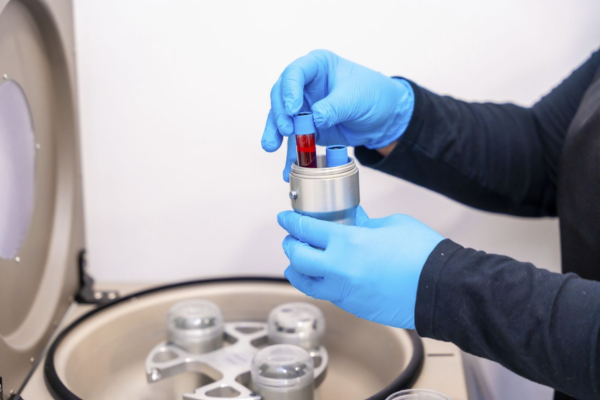 Ovarian rejuvenation PRP Nigeria treatment process at Netcare Fertility Centre clinic lab